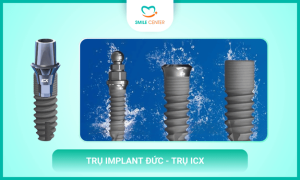 Trụ Implant Đức - Trụ ICX
