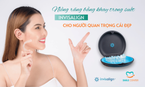 Niềng răng invisalign