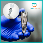Top 9+Trụ răng implant chất lượng và an toàn khi cấy ghép implant