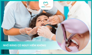 Nhổ răng có nguy hiểm không ?