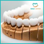 Răng Sứ Sagemax Và Ứng Dụng Trong Trồng Răng Nha Khoa