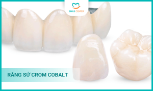 Răng sứ Crom Cobalt là gì?