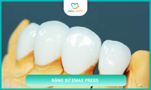 Răng sứ Emax Press là gì?