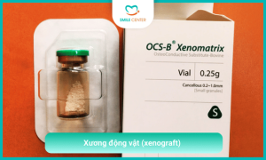 Xương động vật (xenograft)