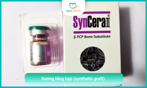 Xương tổng hợp (synthetic graft)