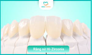 Răng sứ Hi-Zirconia là gì ?