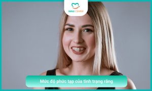 Mức độ phức tạp của tình trạng răng