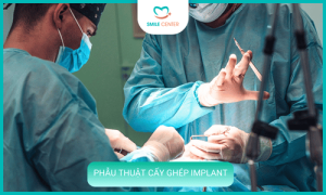 Phẫu thuật cấy ghép implant (1 Giờ - 2 Giờ)